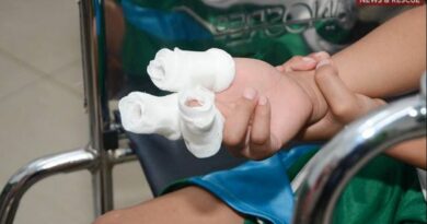 PHILIPPINEN MAGAZIN - NACHRICHTEN - Krankenhäuser wegen Verletzungen durch Feuerwerkskörper in Alarmbereitschaft