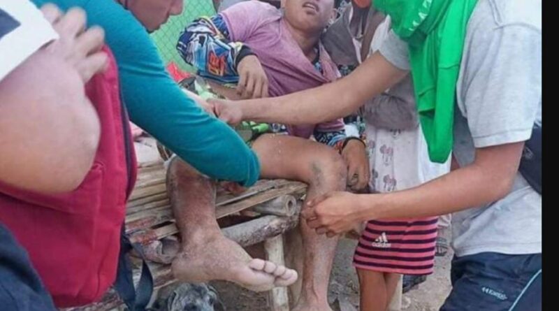 PHILIPPINEN MAGAZIN - NACHRICHTEN - 33 Verletzte beim Abriss an der Patungan-Bucht